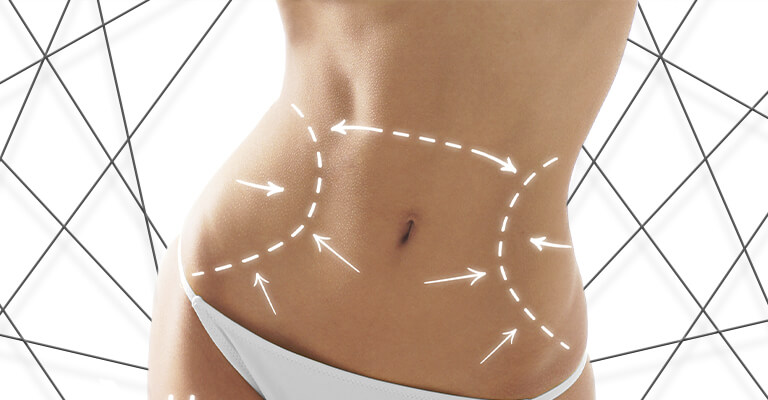 Imagem lipoabdominoplastia